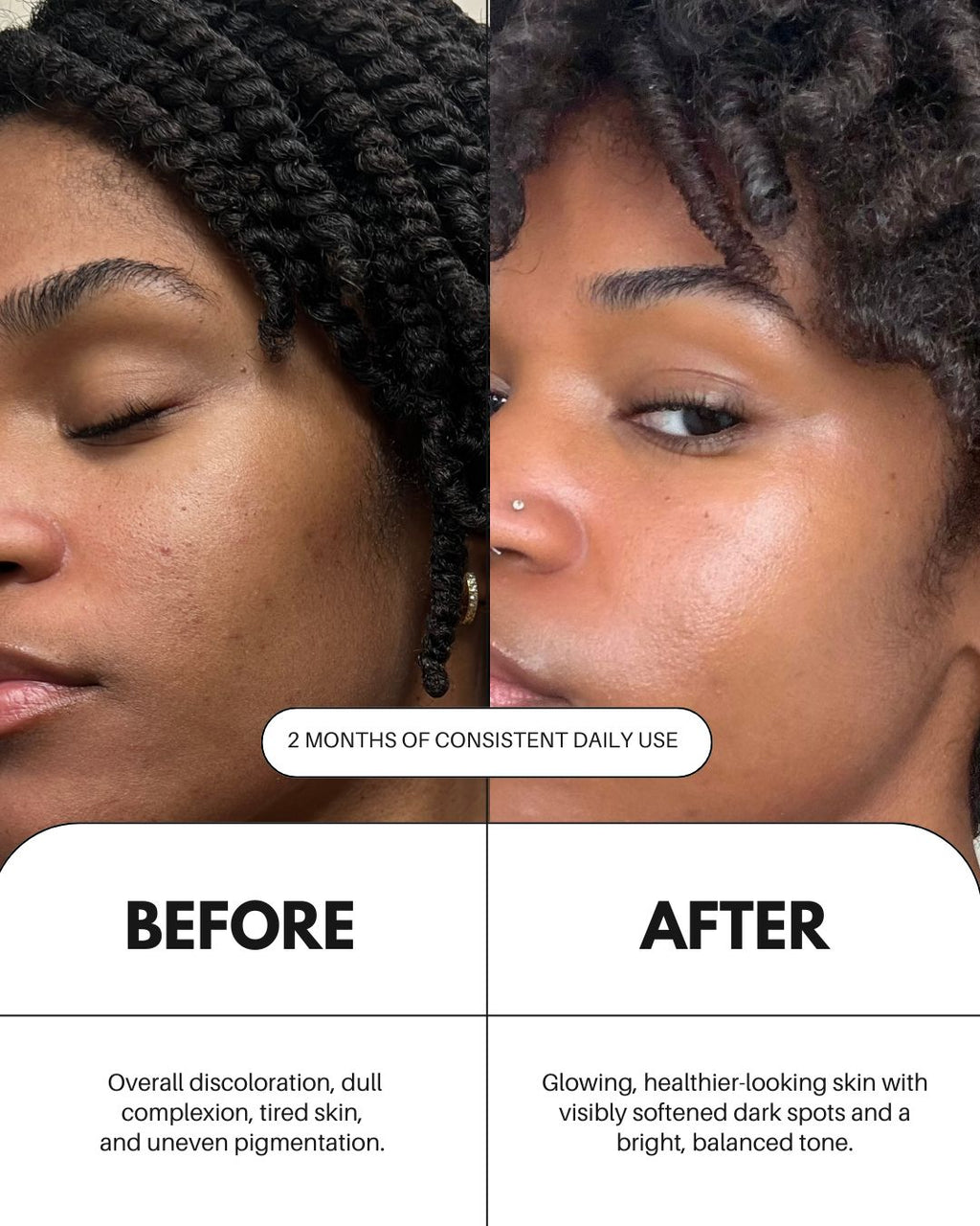 Vitamin C Serum For Face