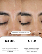 Vitamin C Serum For Face