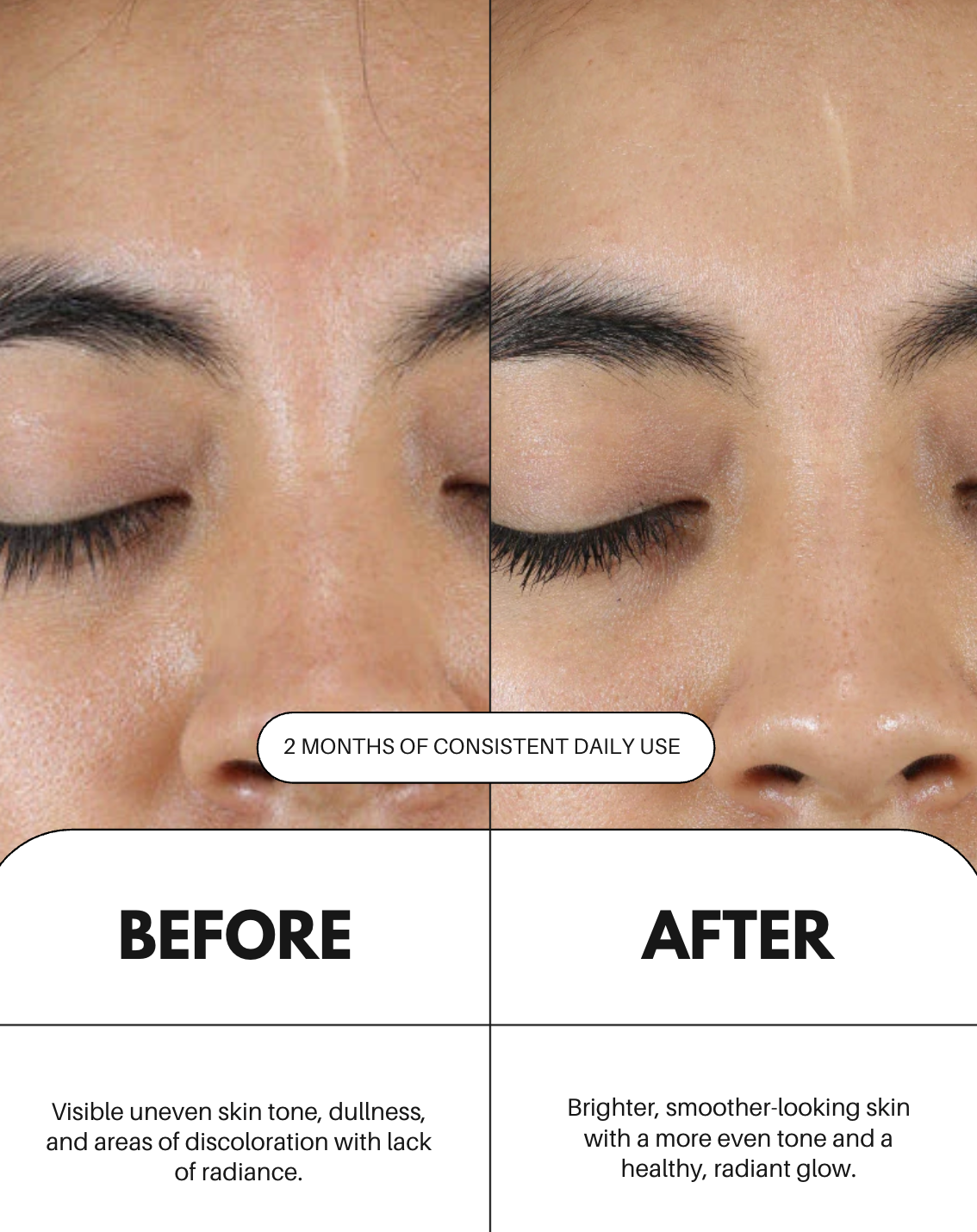 Vitamin C Serum For Face