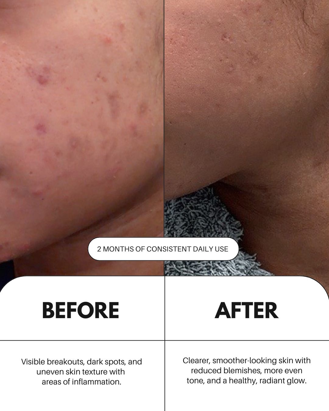Vitamin C Serum For Face